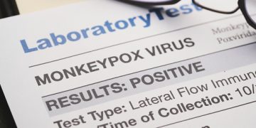 Monkeypox virus test results document/Unsplash