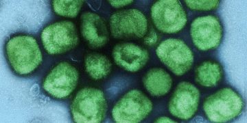 猴痘病毒 NIAID / flickr.com