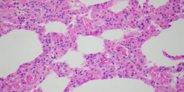 Atlas of Pulmonary Patholo/Flickr